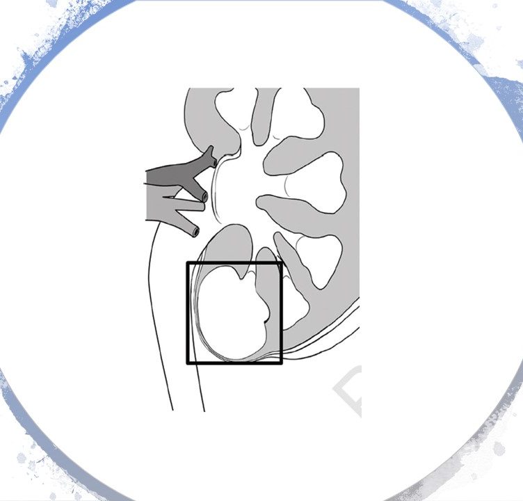 Dr Giacomo Maria Pirola – Urologia e Andrologia